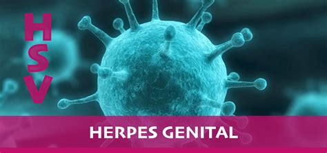 Herpes genital